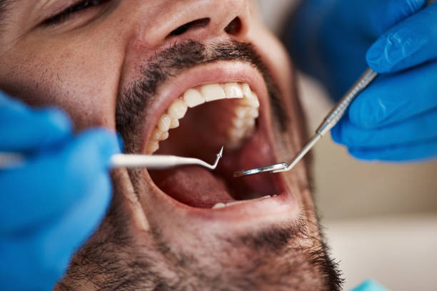 Best Broken or Cracked Tooth Emergency Dentist in Manvel, TX